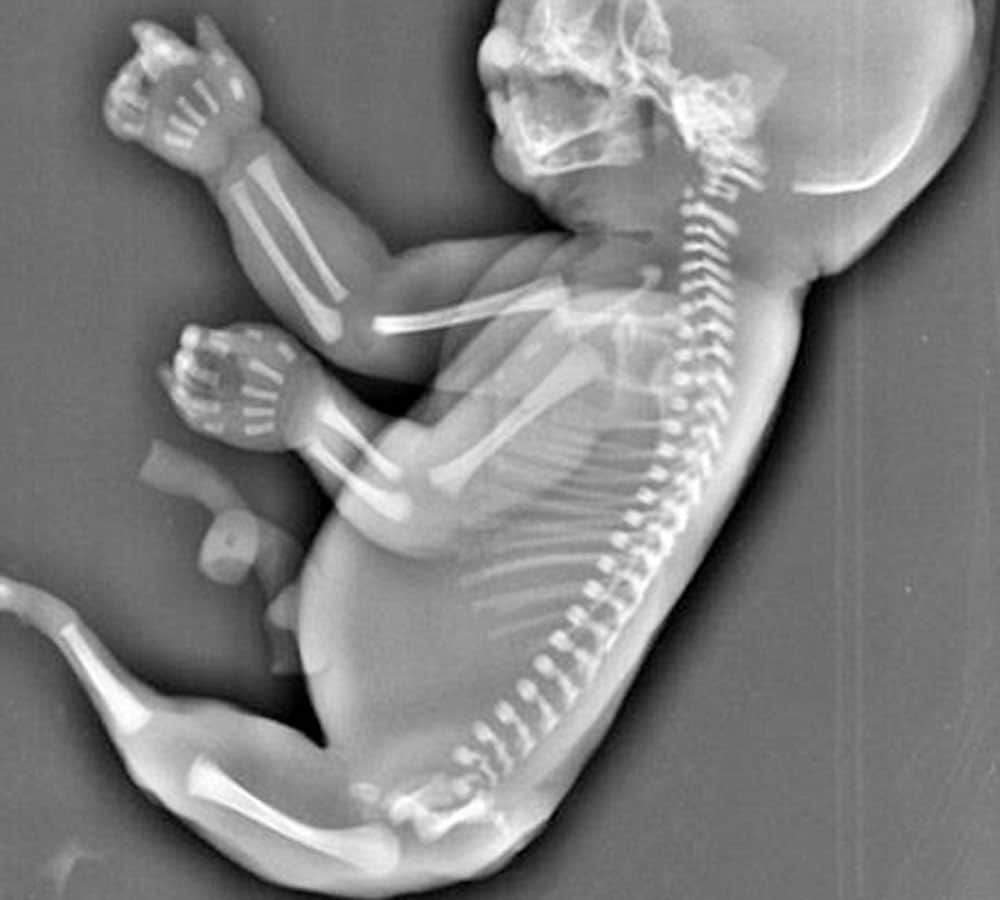 mother found mermaid child after 6 months