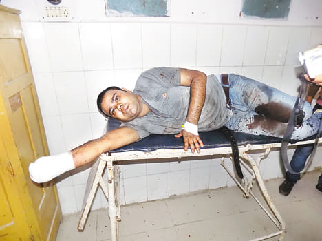 Grenade exploded, the young man's hand blown