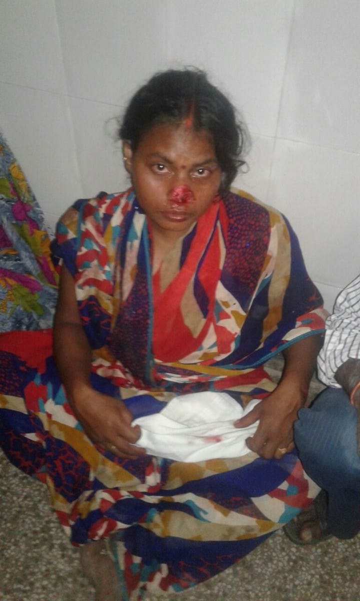 A man bite women's nose