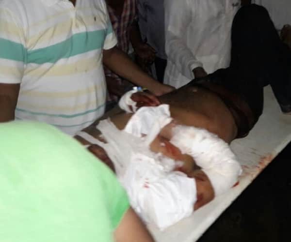  55 injured in an accident in bahraich.
