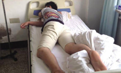 weird news of piles operation