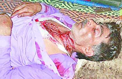 Dalit youth's neck shoal