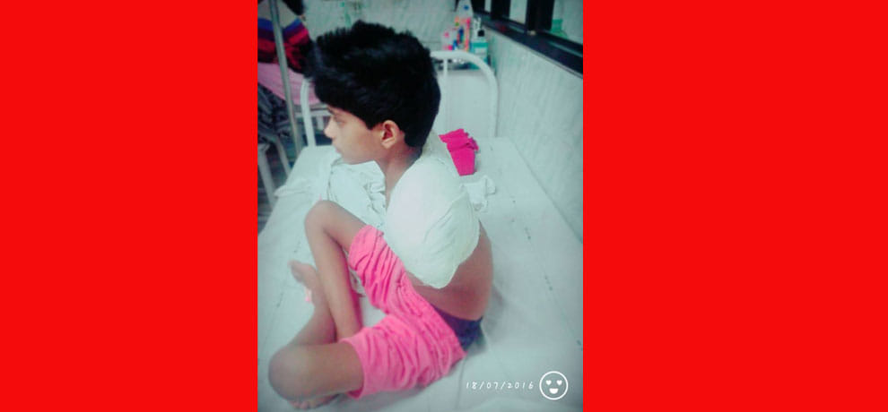 hi tension current, 3 operation and looses both hand then also tied rakhi to brother with legs