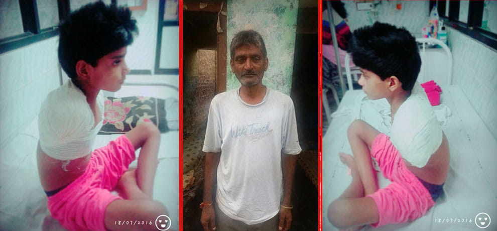 hi tension current, 3 operation and looses both hand then also tied rakhi to brother with legs