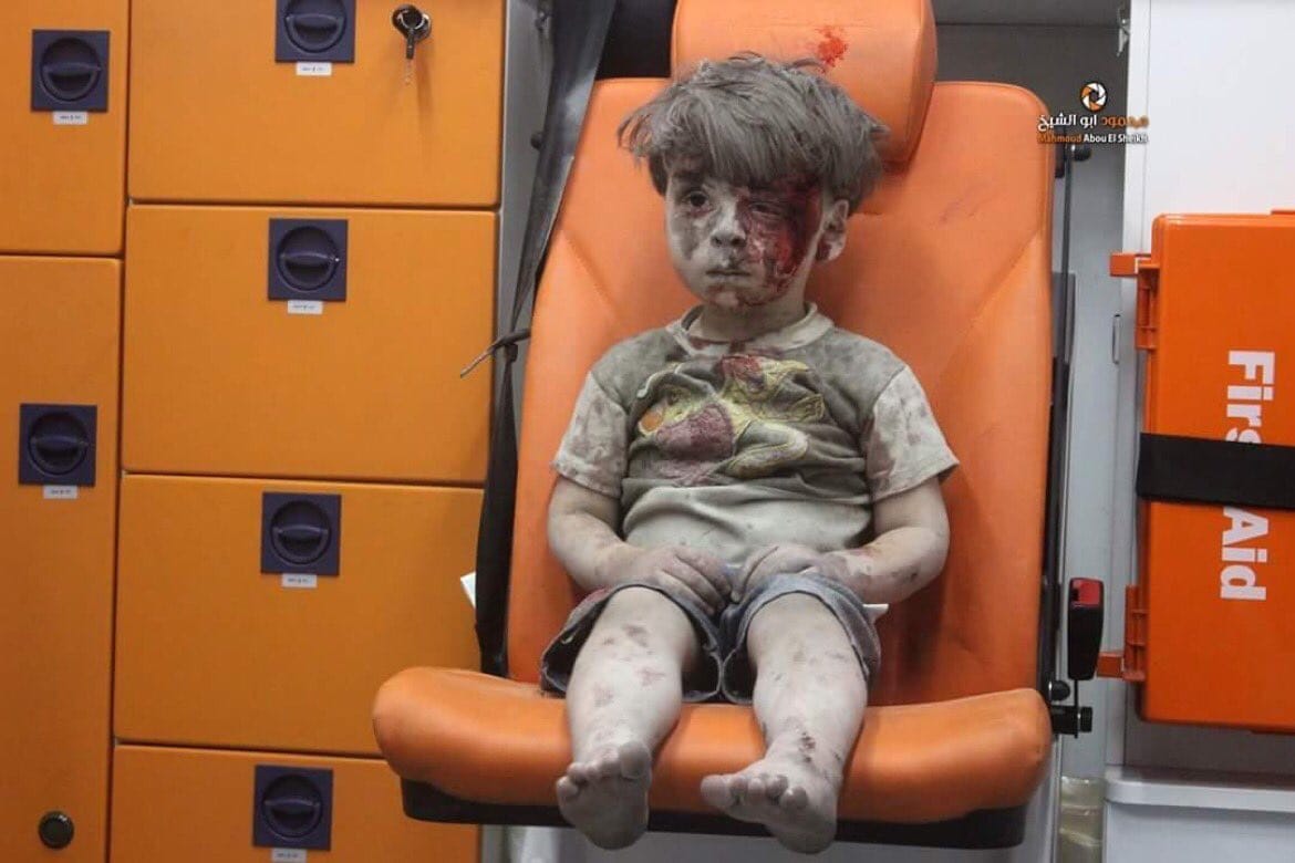Haunting image of Syrian boy rescued from Aleppo rubble