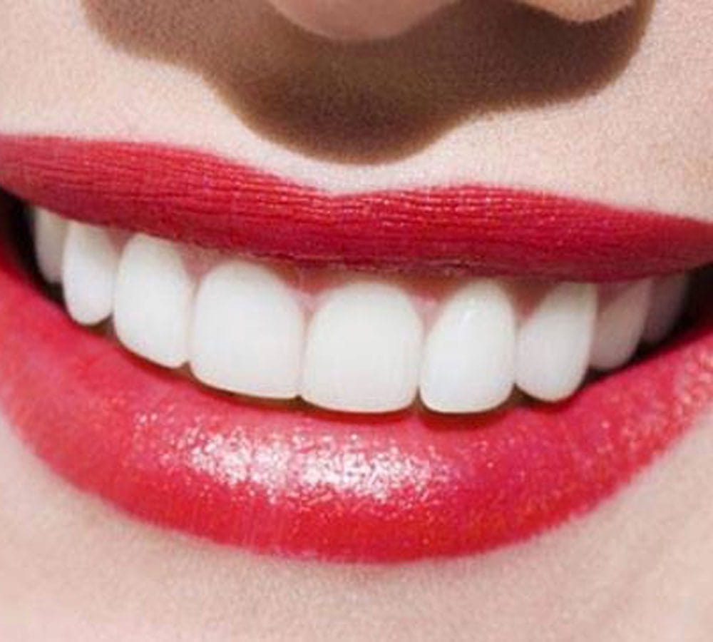 home remedies for gum bleeding