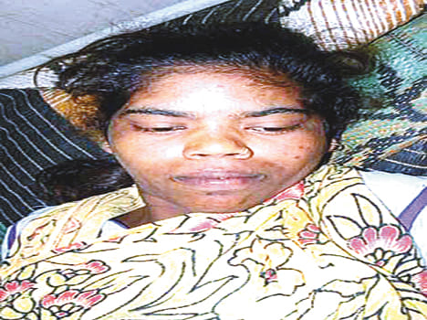 Including five sick from eating mutton couple