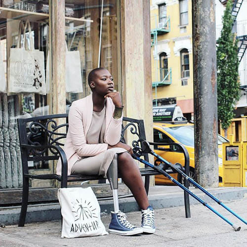 Amputee Woman Becomes Famous Fashion Blogger