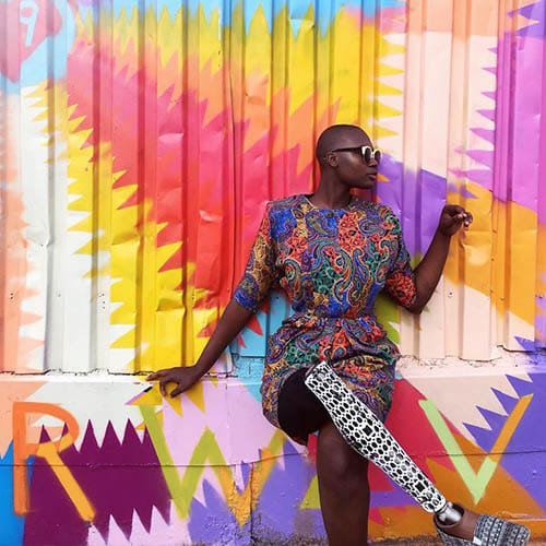 Amputee Woman Becomes Famous Fashion Blogger