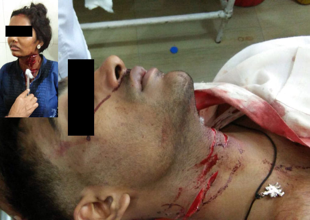 boy attacks on lover cut her neck in at a meerut hotel