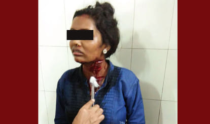boy attacks on lover cut her neck in at a meerut hotel