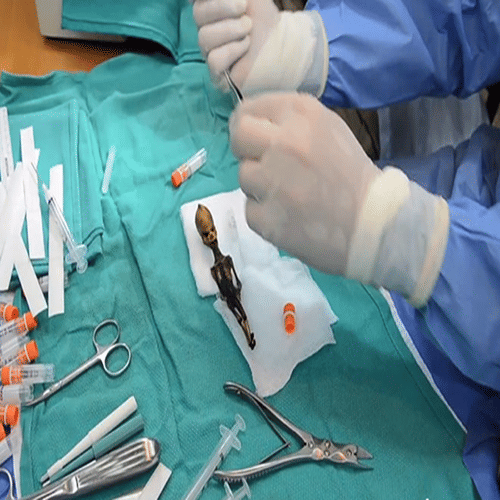 Skeleton Of Alien Looking Tiny Creature 