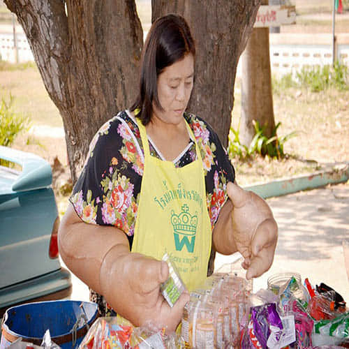 Woman with world's largest hands