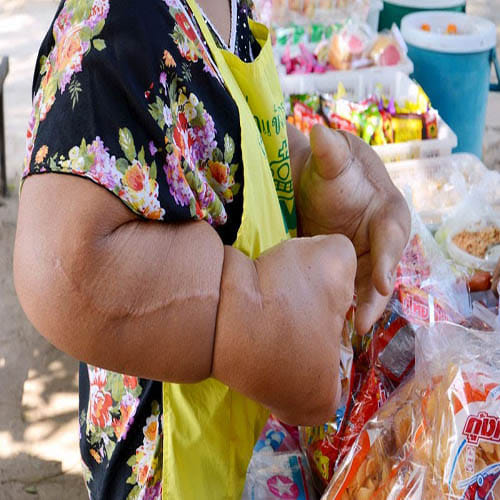 Woman with world's largest hands