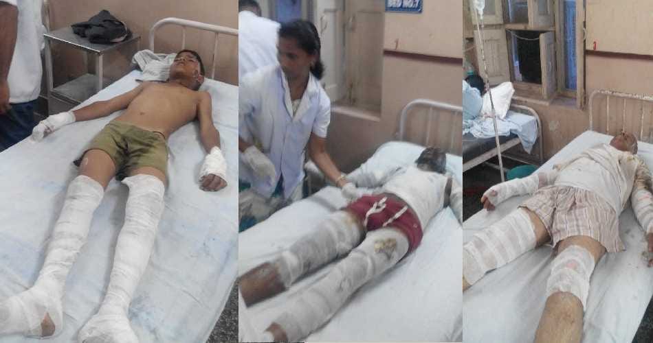 gogamedi, hydrozen gas, ballon explode, 25 burn, gogamedi festival, accident