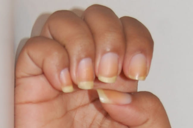 palmistry sign of impotency 