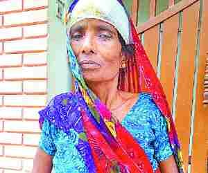 Acid attack on Women