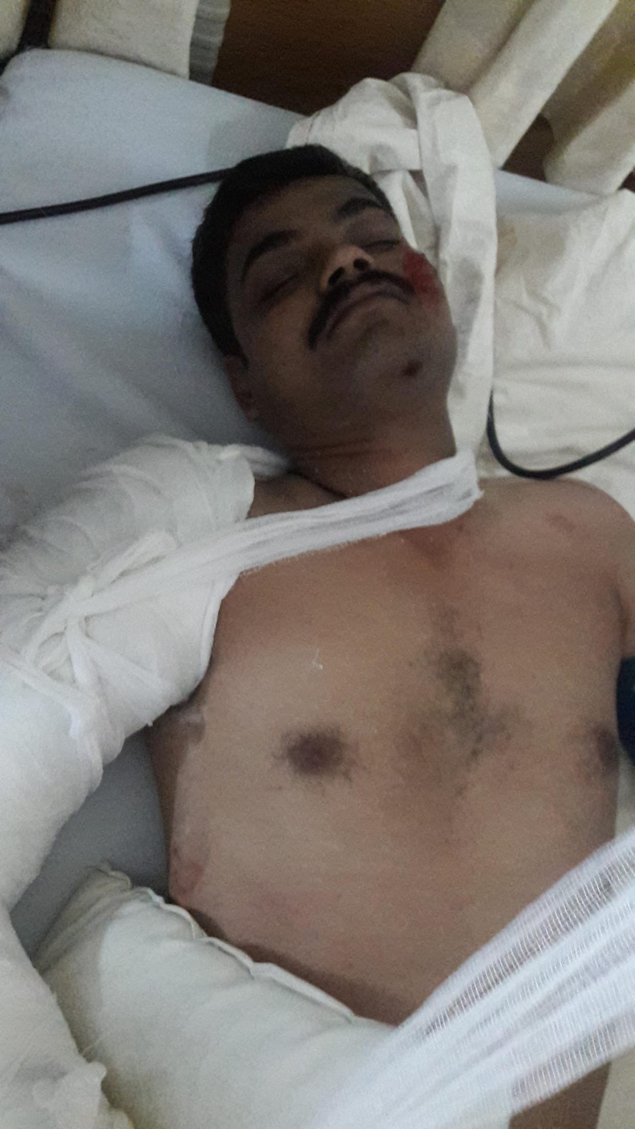 policeman injured during stunt by boy in lucknow