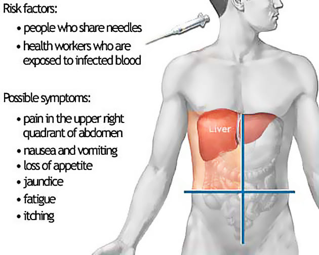 Hepatitis-C virus