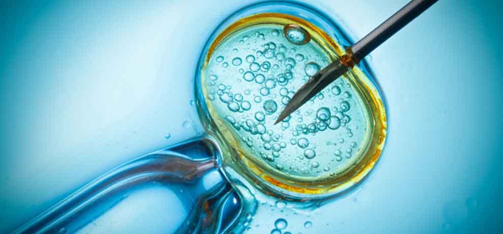 new technique economical comparision in IVF, will be fulfilled desire to get the child