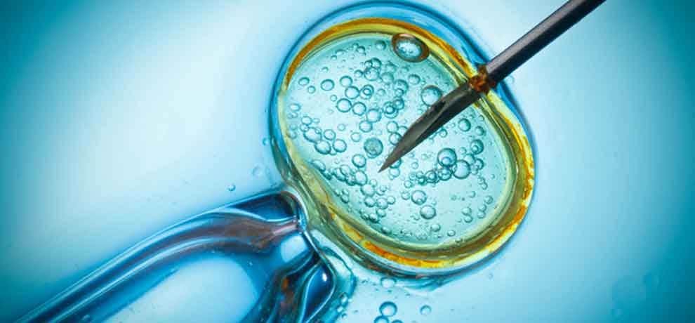 what is ivf technology know about everything