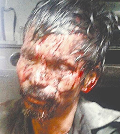 Madan was further battered Leopard