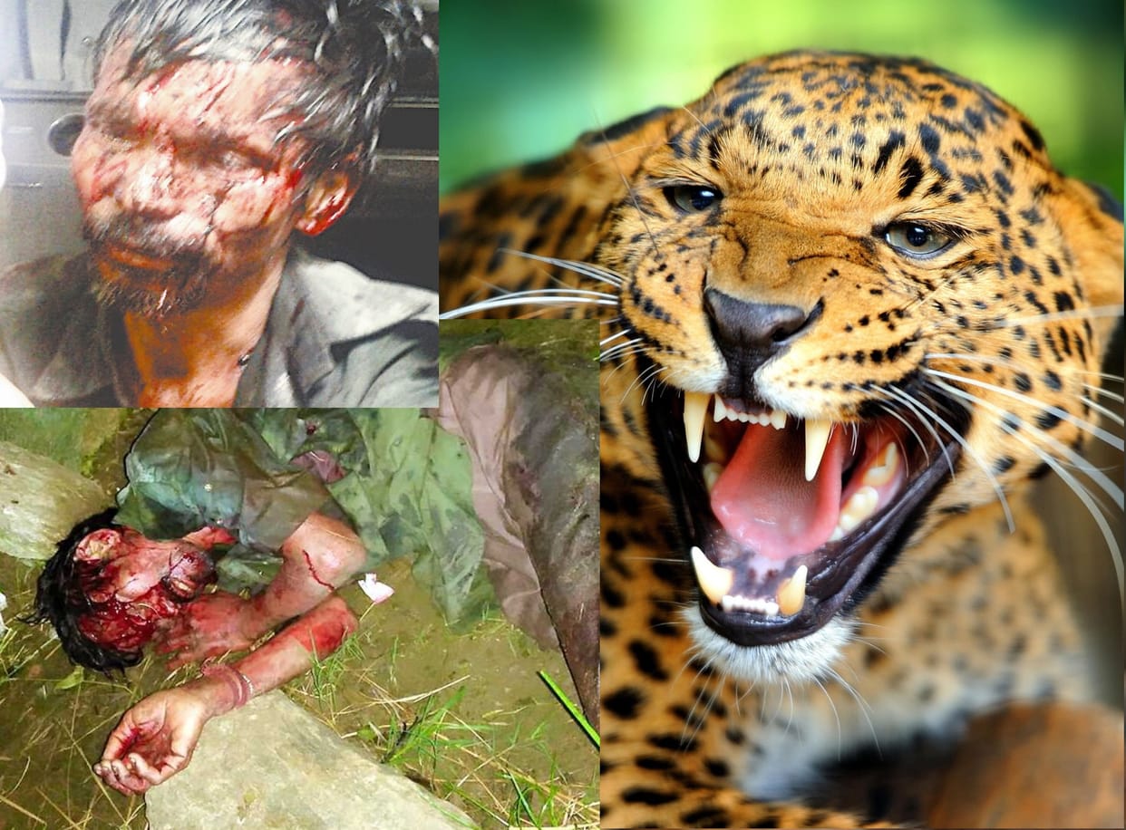 madan fought with leopard and saved life.
