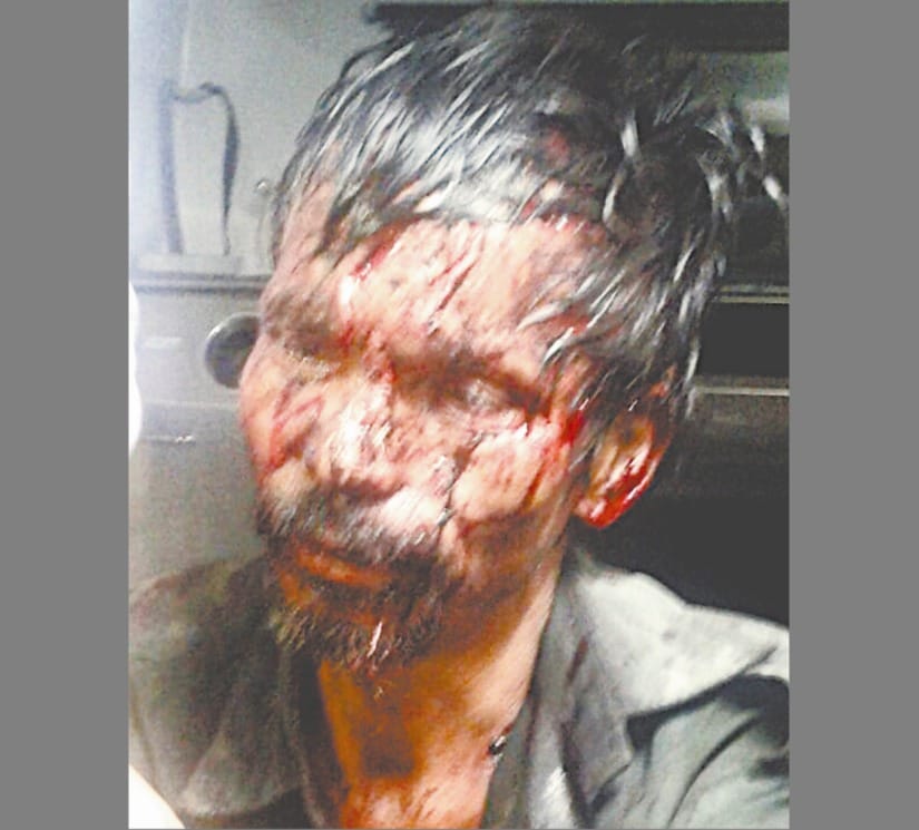 madan fought with leopard and saved life.