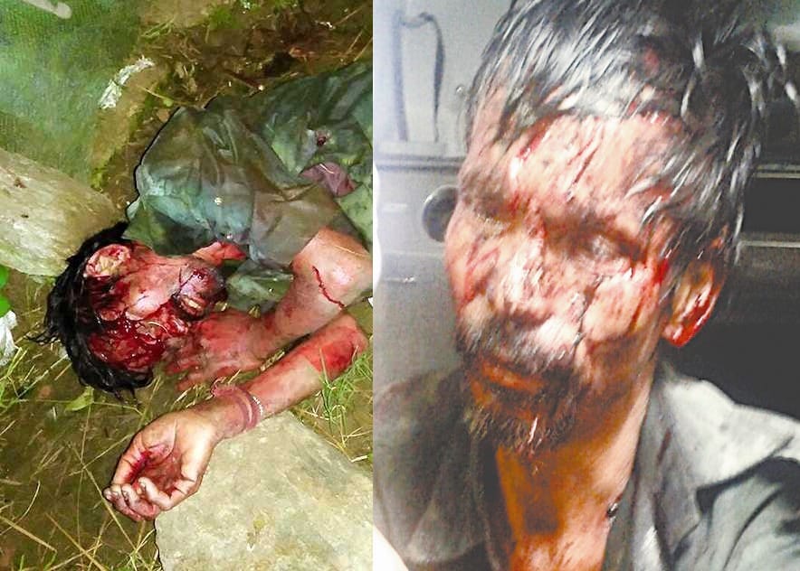 madan fought with leopard and saved life.