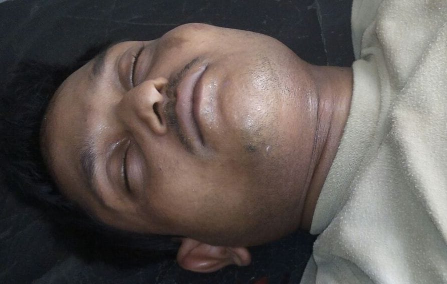 youth hanged, serious