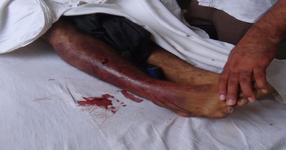 in Honor killings 12th class student killed beating with sticks