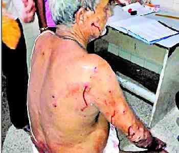 Younger brother shot, three injured