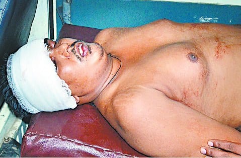 Bareilly College student shot sensation