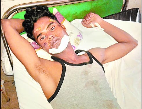 Three persons injured in road accidents