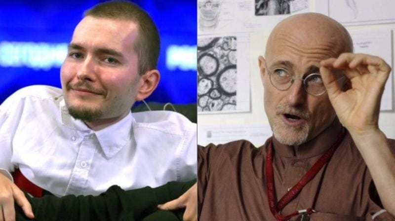 Doctors team seeking to pull off the world's first ever head transplant