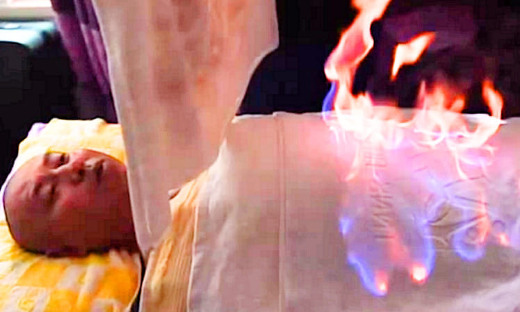 chinese fire therapy for treatment