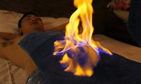 chinese fire therapy for treatment