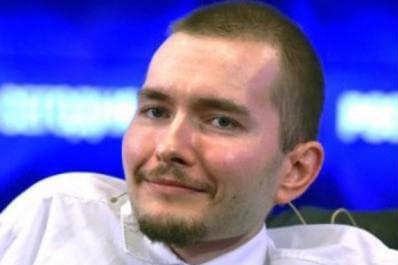 Doctors team seeking to pull off the world's first ever head transplant