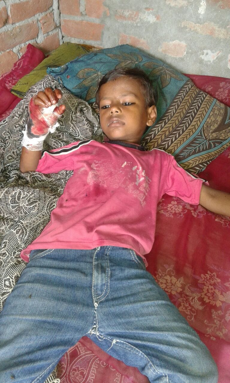 Seven years on innocent Crocodile slipped, injured