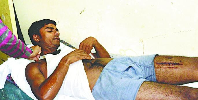 Youth are being attacked by a leopard on defecation