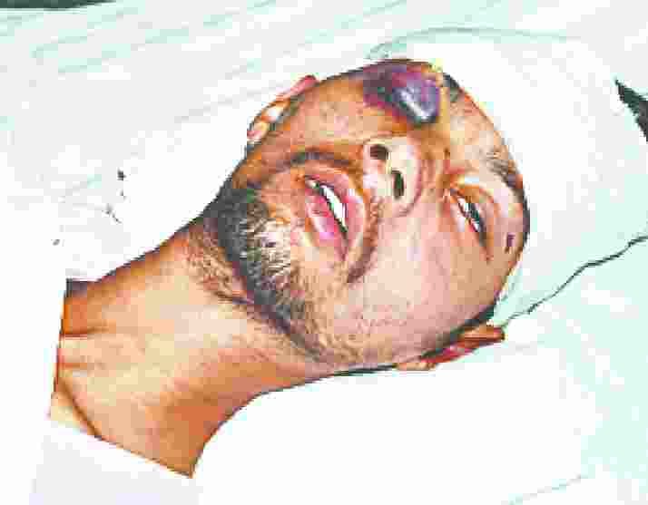 yuvak ki behrehmi se pitaai