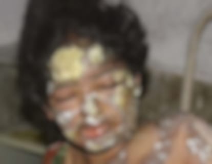 woman burnt her face on because of her fight with her daily 