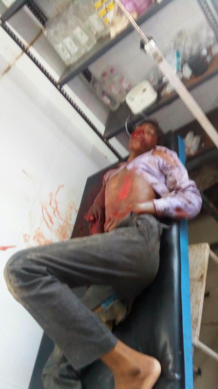 bike bus accident in lucknow