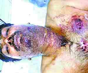 Central bank employee shot at