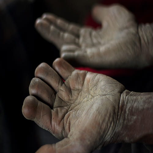 Finger Cutting Tradition in Papua