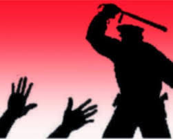 Third Degree on youth in manpur police station