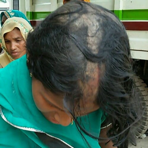 Attempted rape by sister's husband, Viraed Poles in the private part of the women in kanpur