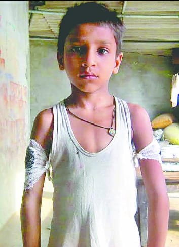 weak in studies of the nursery baby beaten, injured