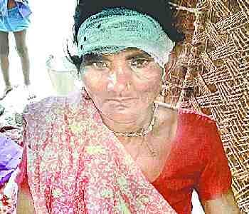 ladies attacked by leopard