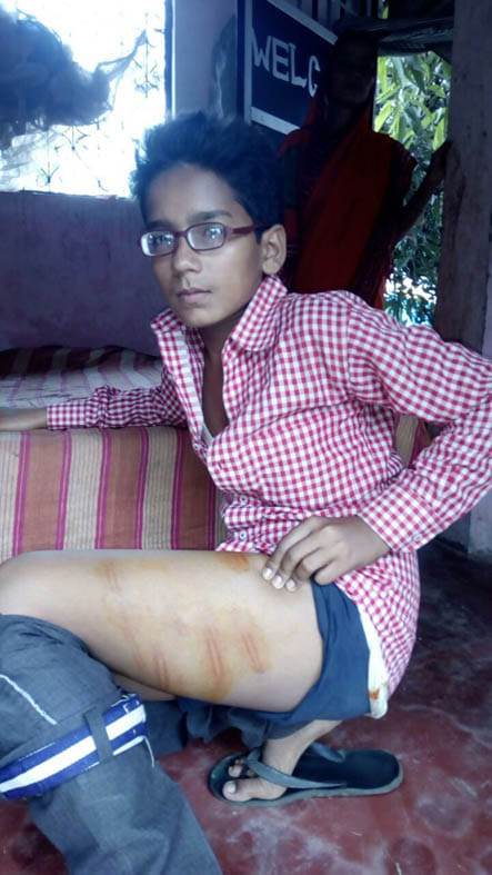 techers beaten class 8th student